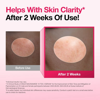 ANUA Niacinamide 10 TXA 4 Serum
